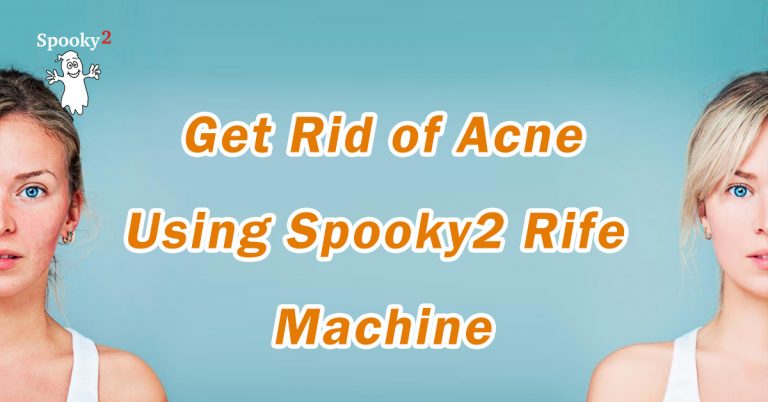 Get Rid of Acne Using Spooky2 Rife Machine - Spooky2