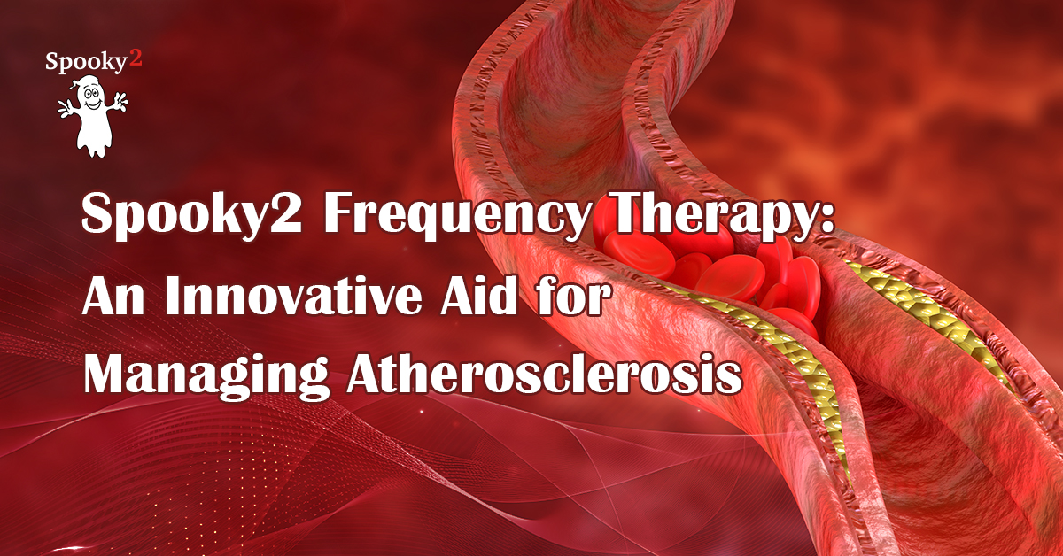 Spooky2 Frequency Therapy An Innovative Aid for Managing Atherosclerosis